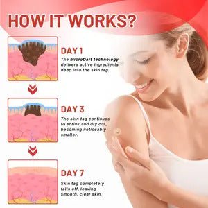 Derma Smooth Skin Tag Removal Patch - 72 Patches